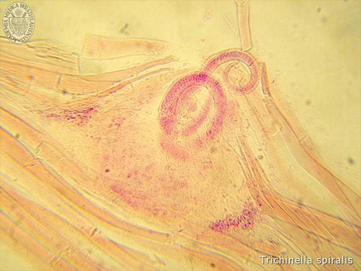 Parazytologia - Trichinella spiralis1.jpg