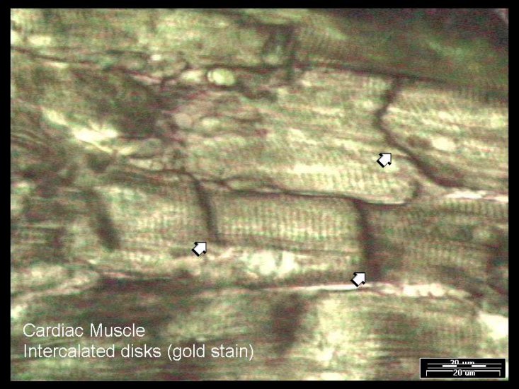 MUSCLE TISSUE - 14-Cardiac Muscle-intercalated disks.jpg