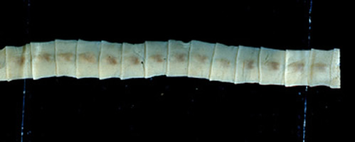 Płazińce - Diphyllobothrium latum - bruzdogłowiec szeroki 2.jpg